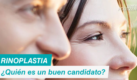 ¿Quién es un buen candidato para la rinoplastia?