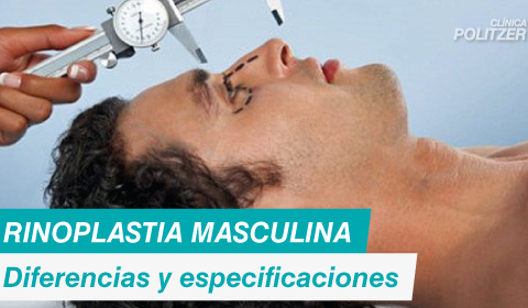 Rinoplastia para hombres